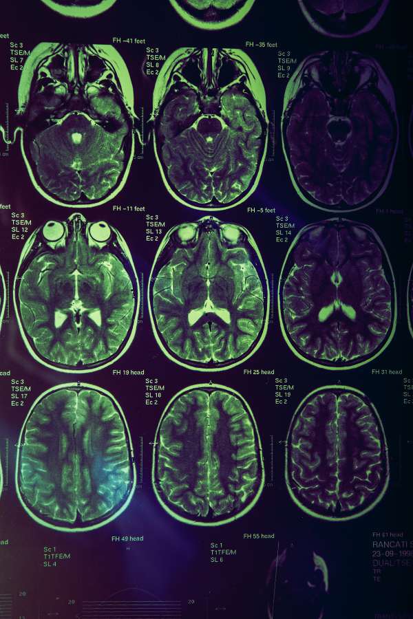 Tender Natural Touch Multi-Care Foundation - TNT Multi-Care Multi-Care Foundation - Yolanda D Jones Executive Director